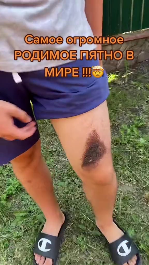 @mmmbxklmn
