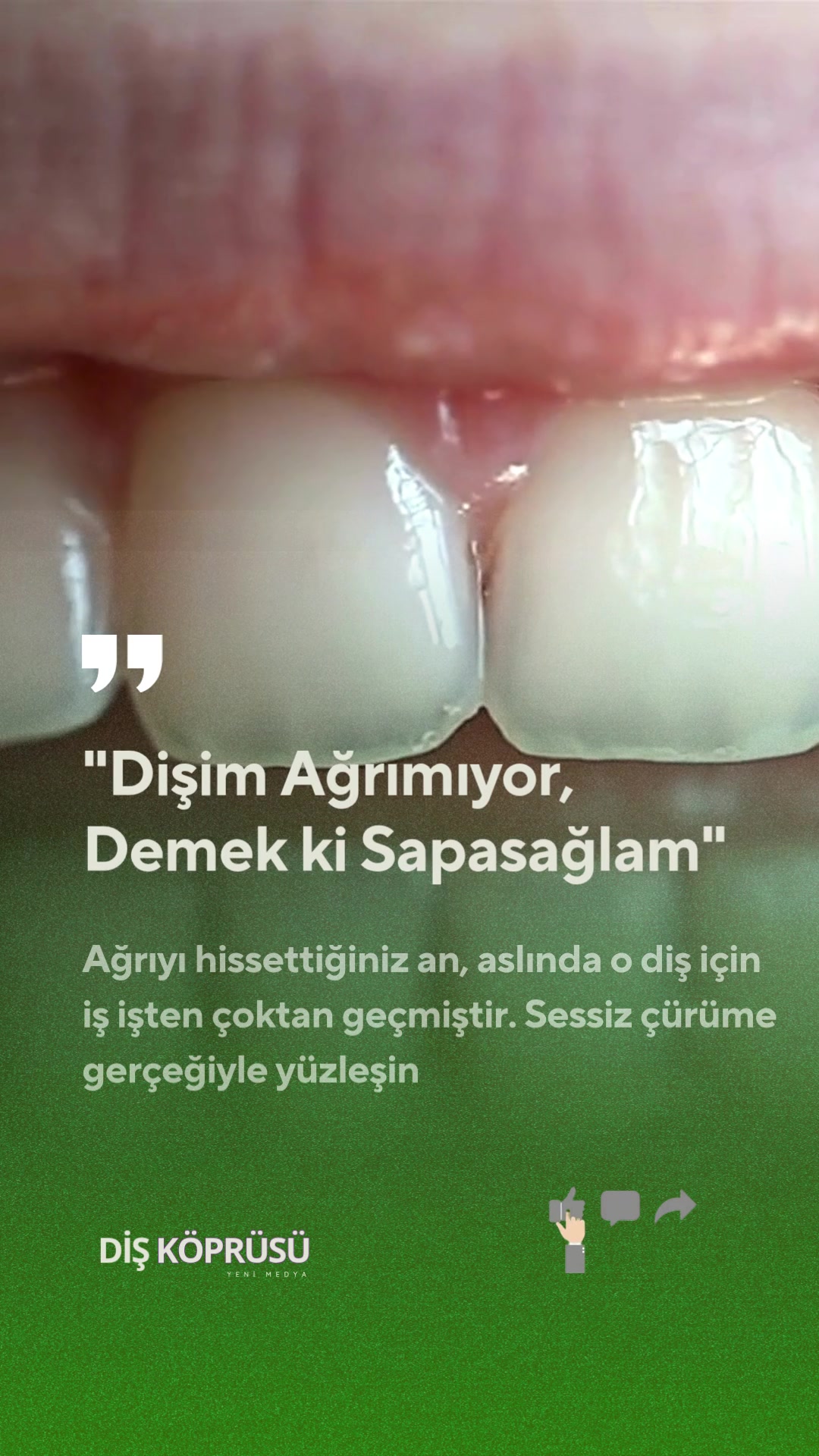 @Diş Köprüsü | Yeni Medya
