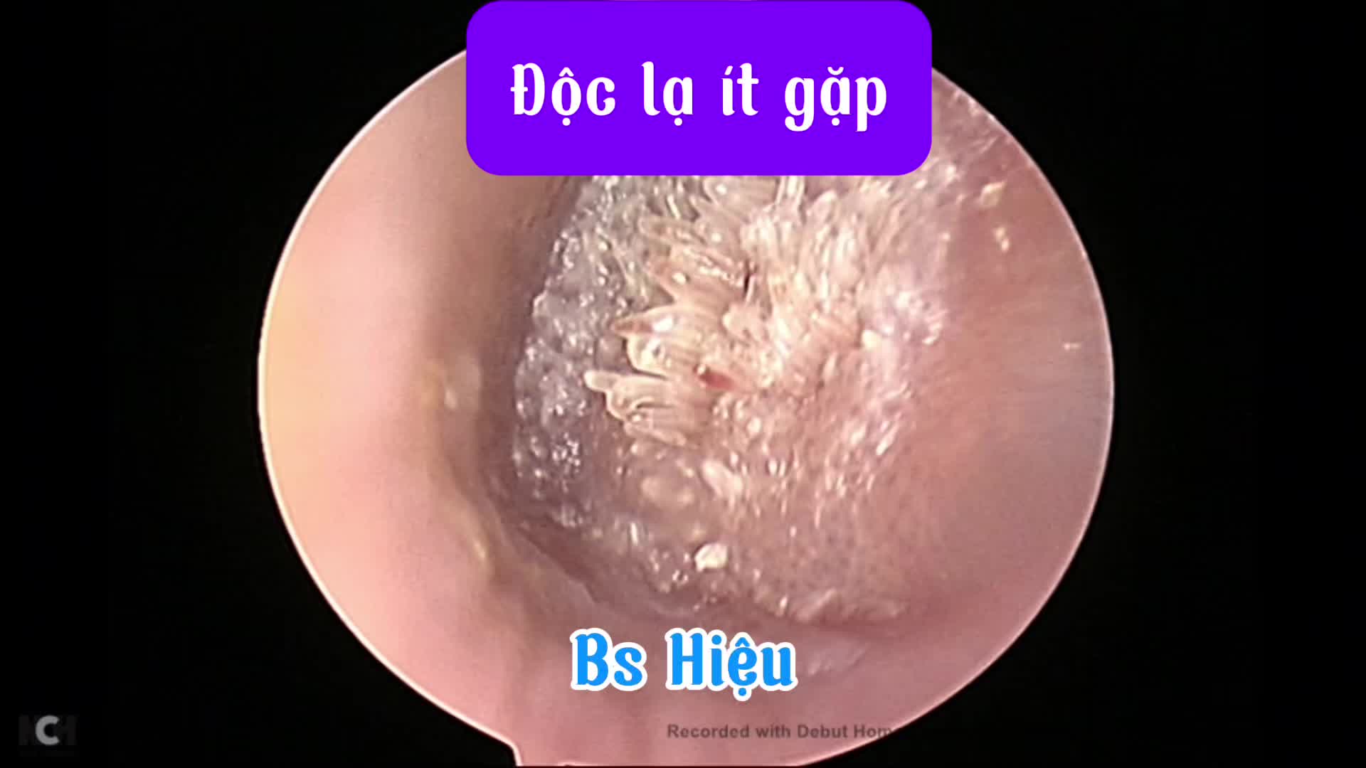 @Bs Hiệu Tai Mũi Họng Long Bi&ecirc;n