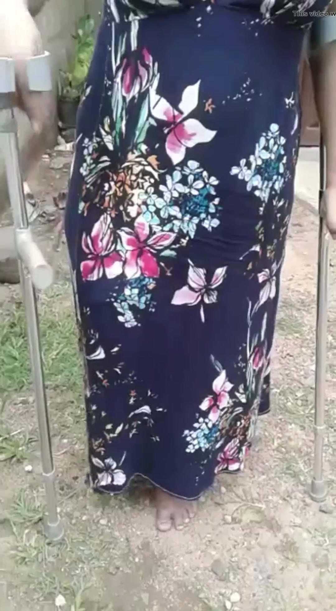 @AmputeeDevotee