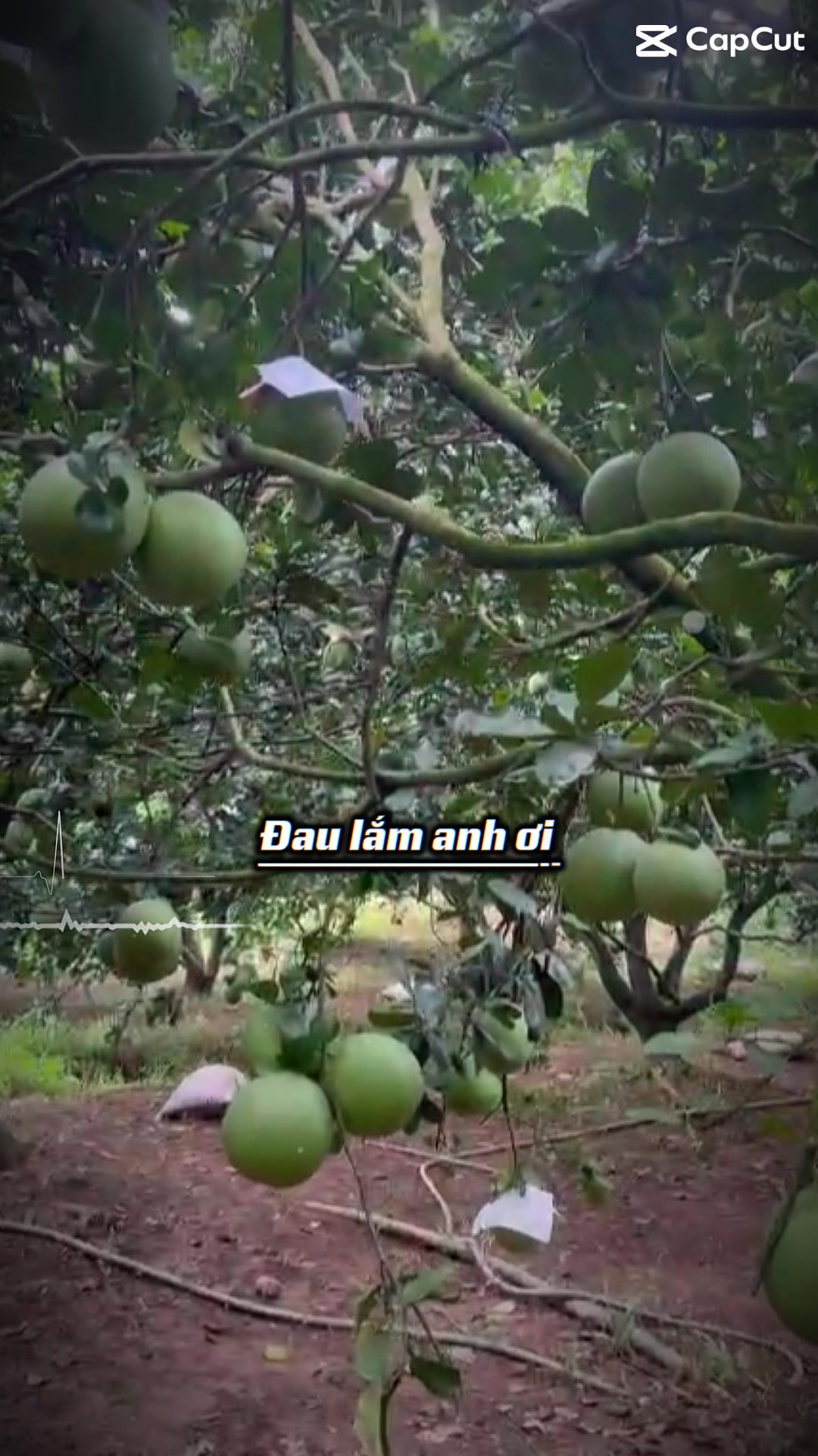 @Bàn tay nhỏ 63B3
