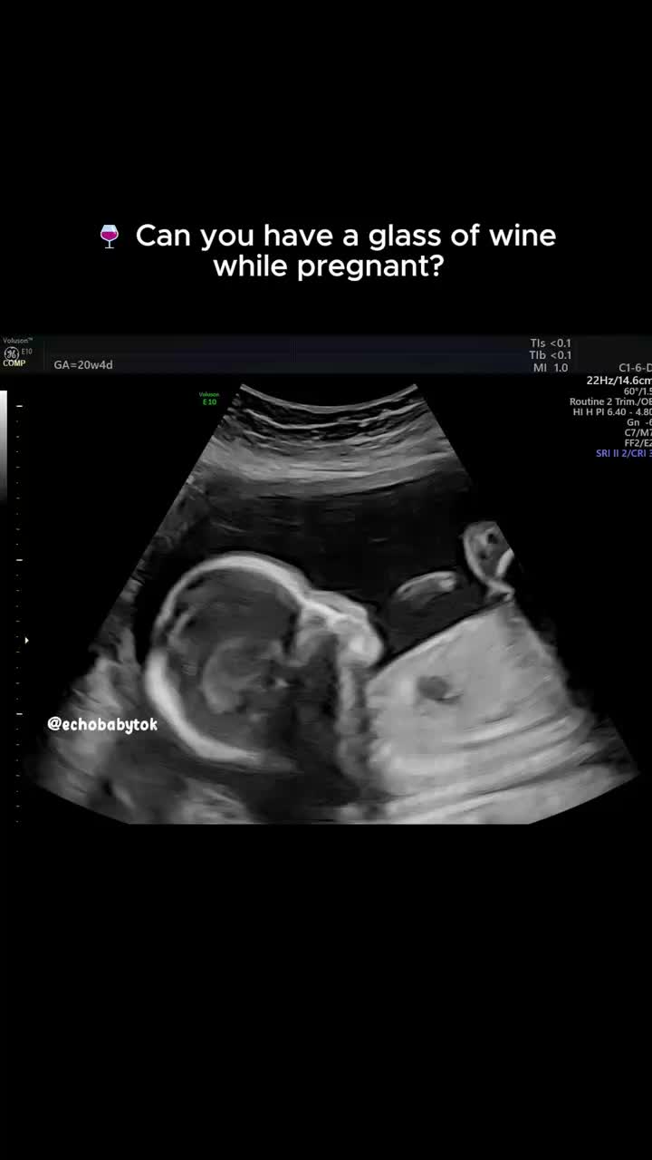 @Echobaby