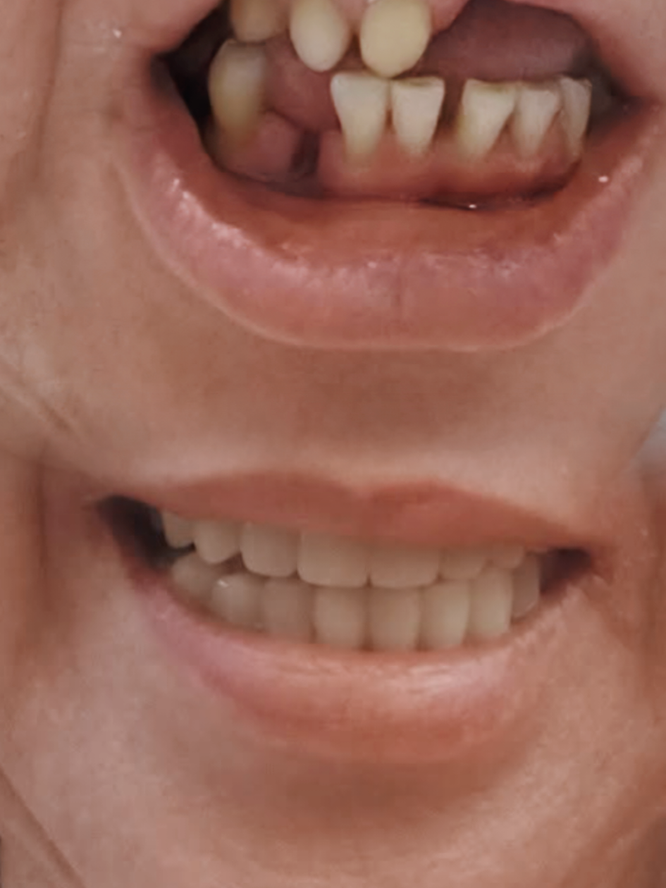 @Pearly Smile