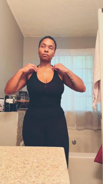 @Baldbeauty39