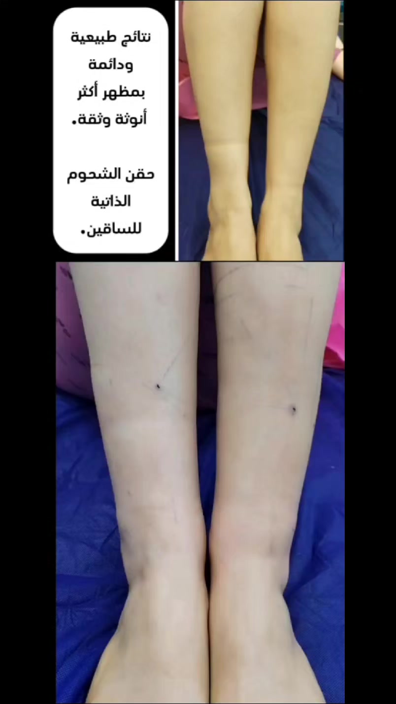 @الدكتورة زهراء حازم