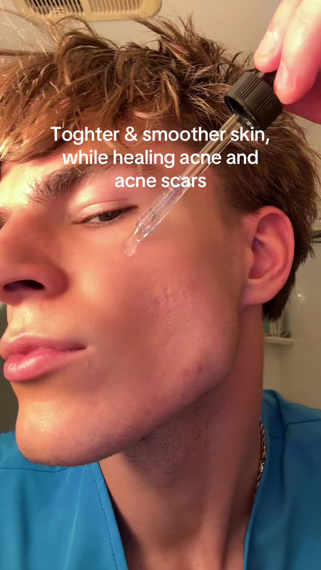 @Finn