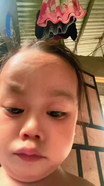 @chin