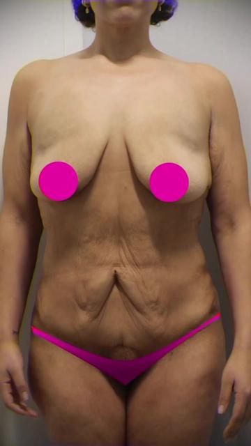 @CG Cosmetic Surgery | Miami