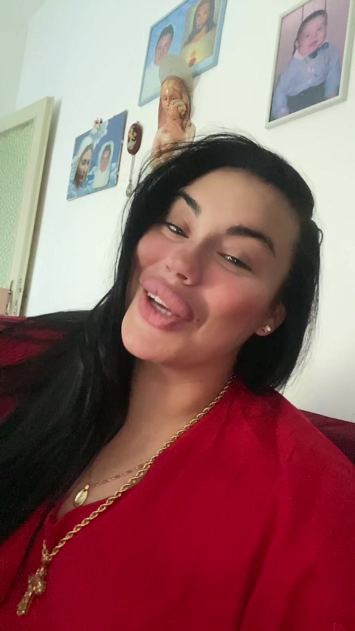 @Alessia albino