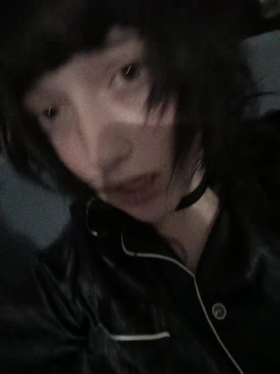 @xilo