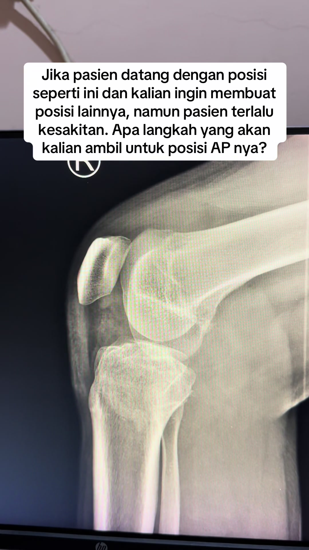 @Sobat Radiology