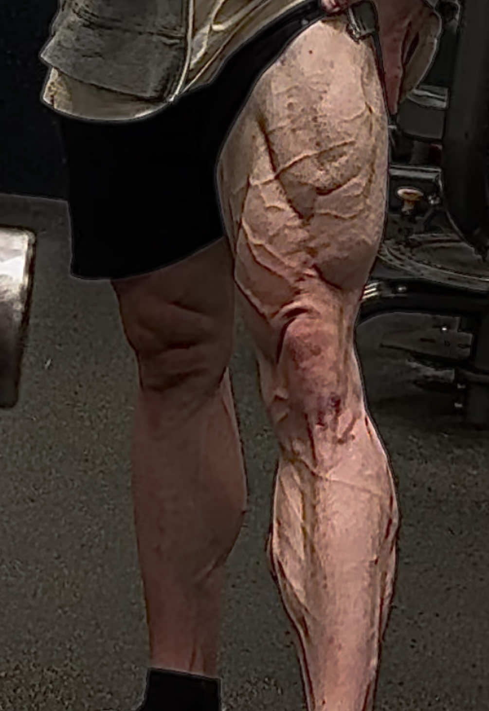 @LucasFit