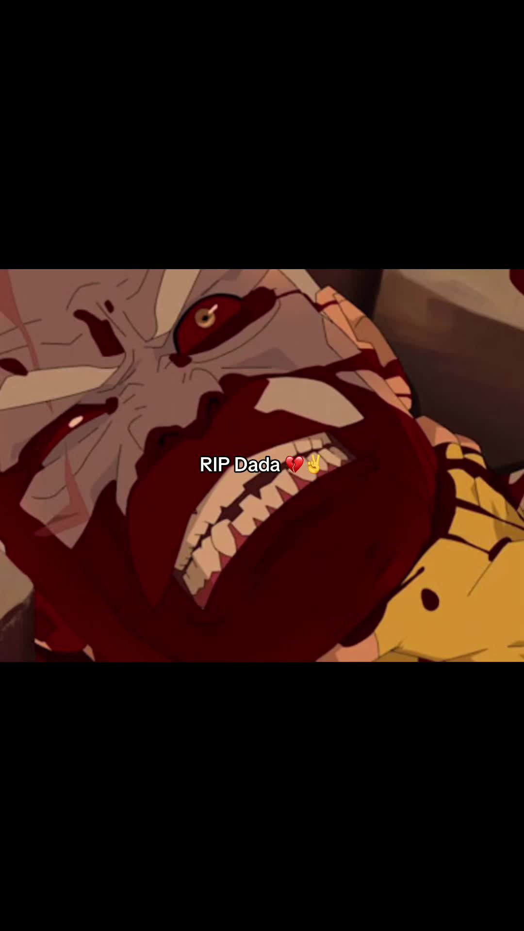 @Kieran&rsquo;s Missing Eyes
