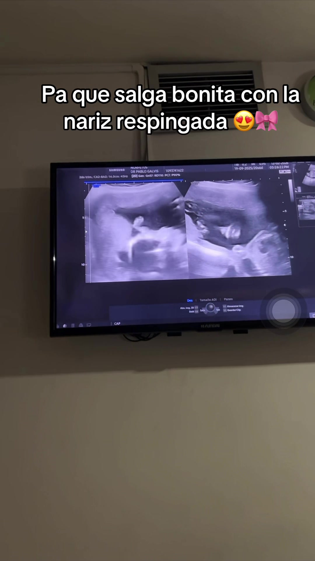 @alehyuga_