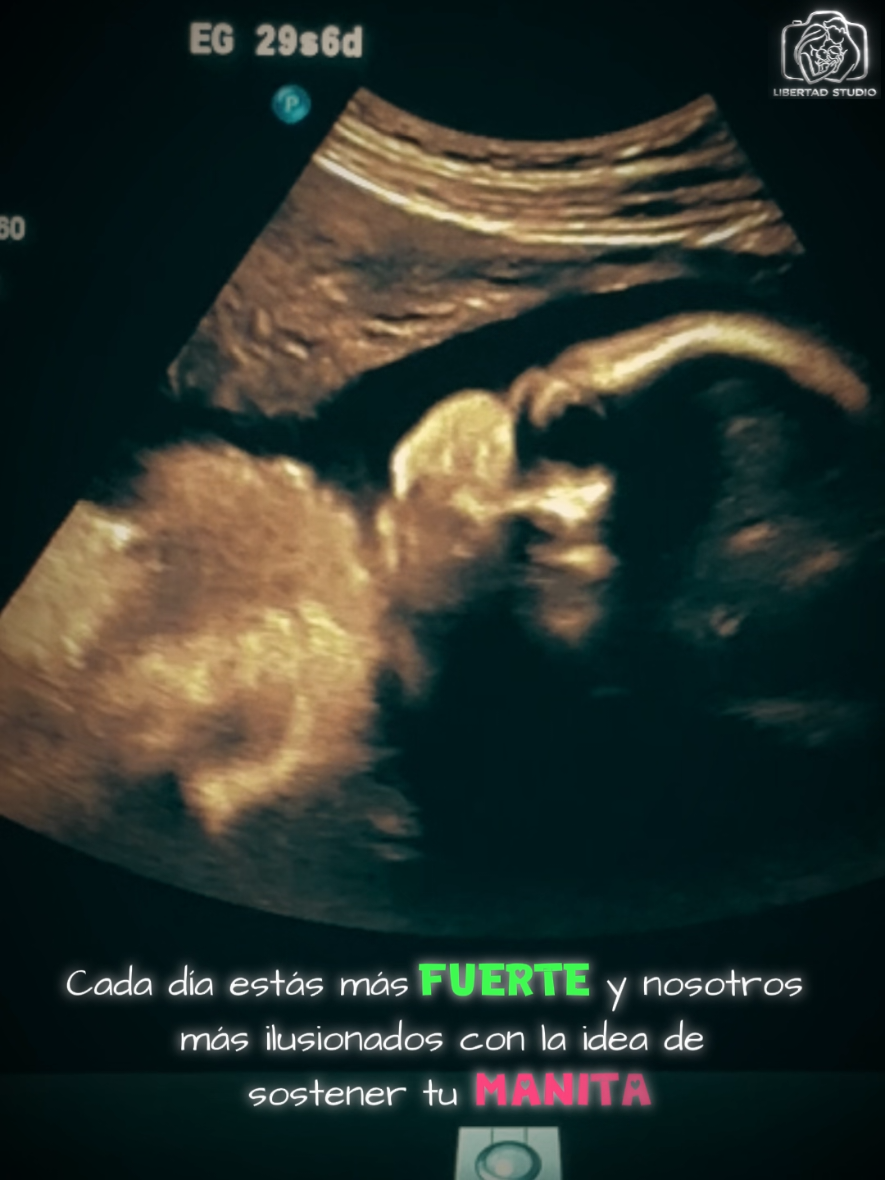 @ECOGRAFIAS LIBERTAD 8K
