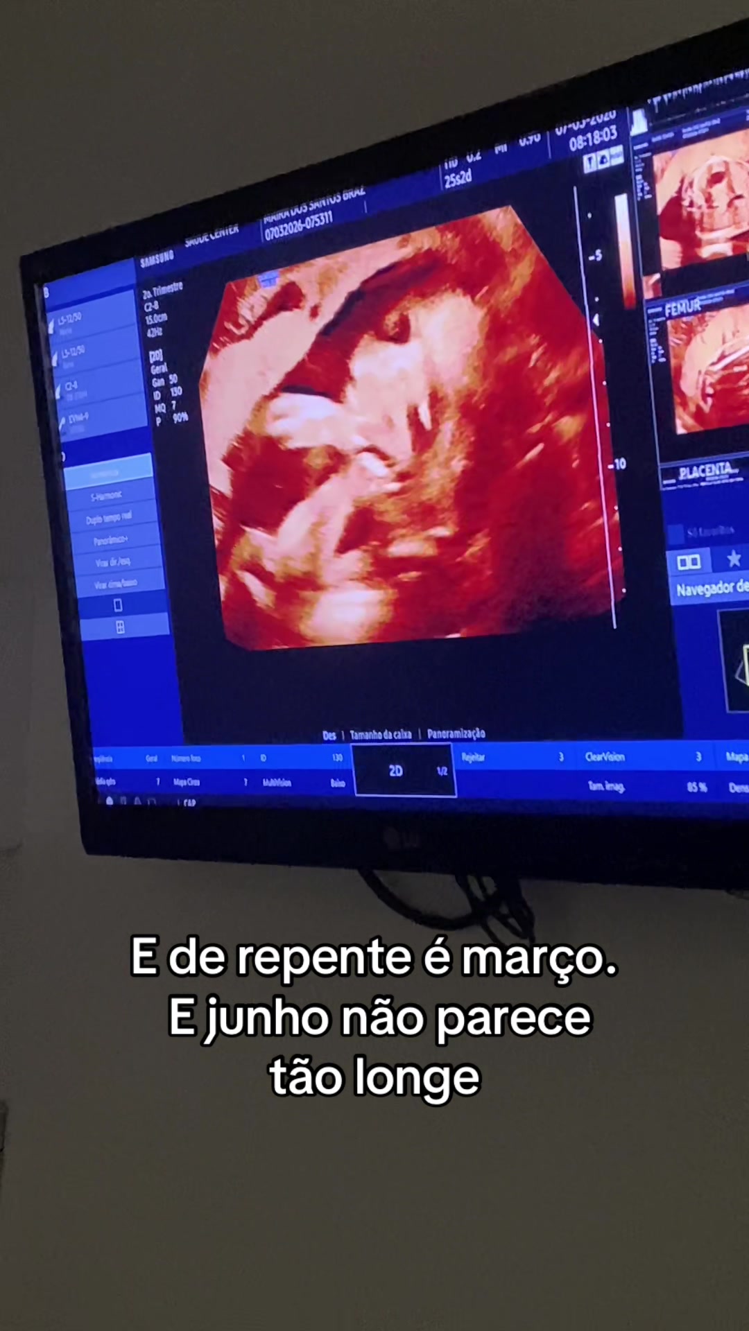 @Maira Silva
