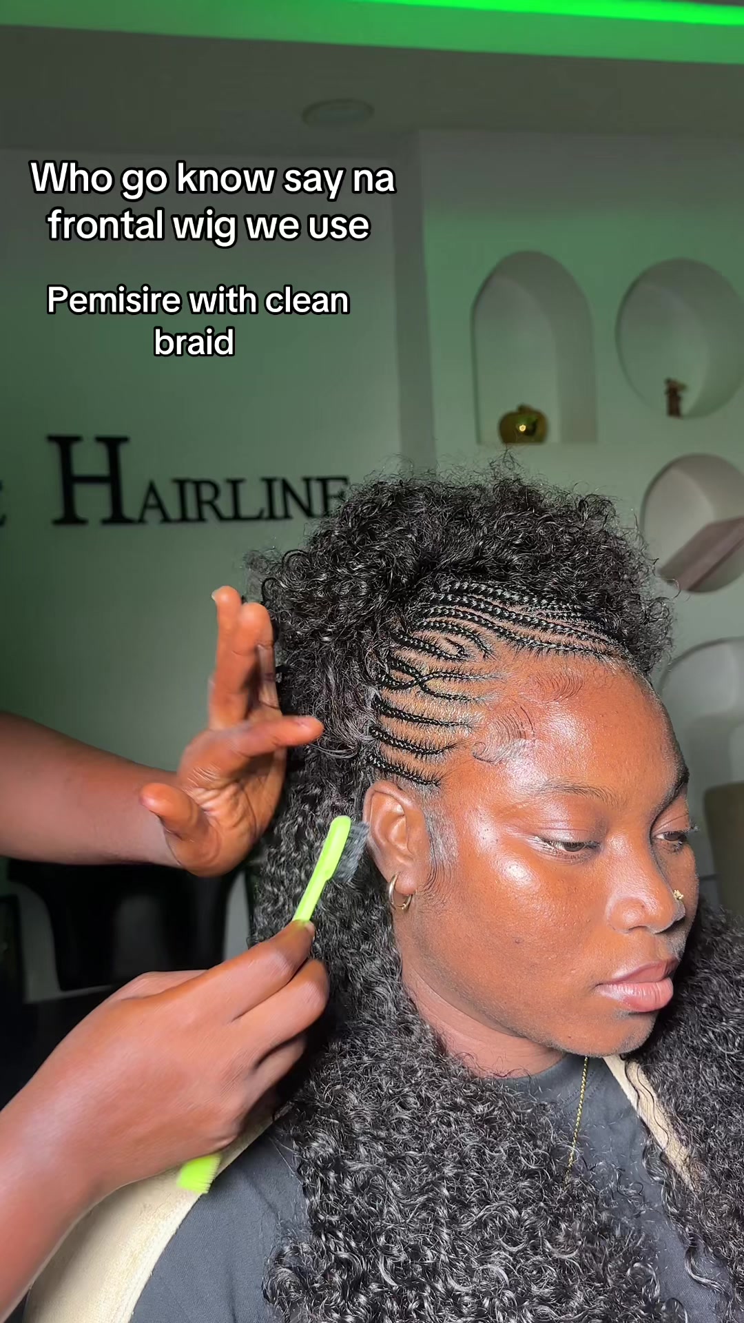 @Pemisire hairline