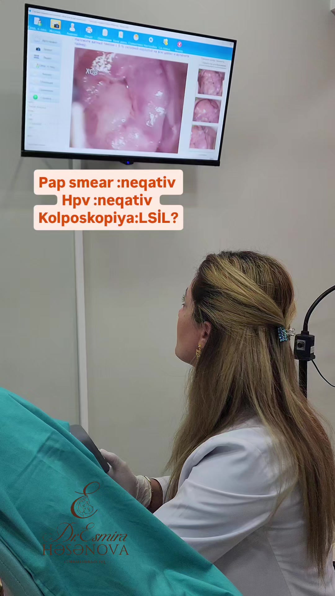 @Ginekoloq Esmira Hasanova