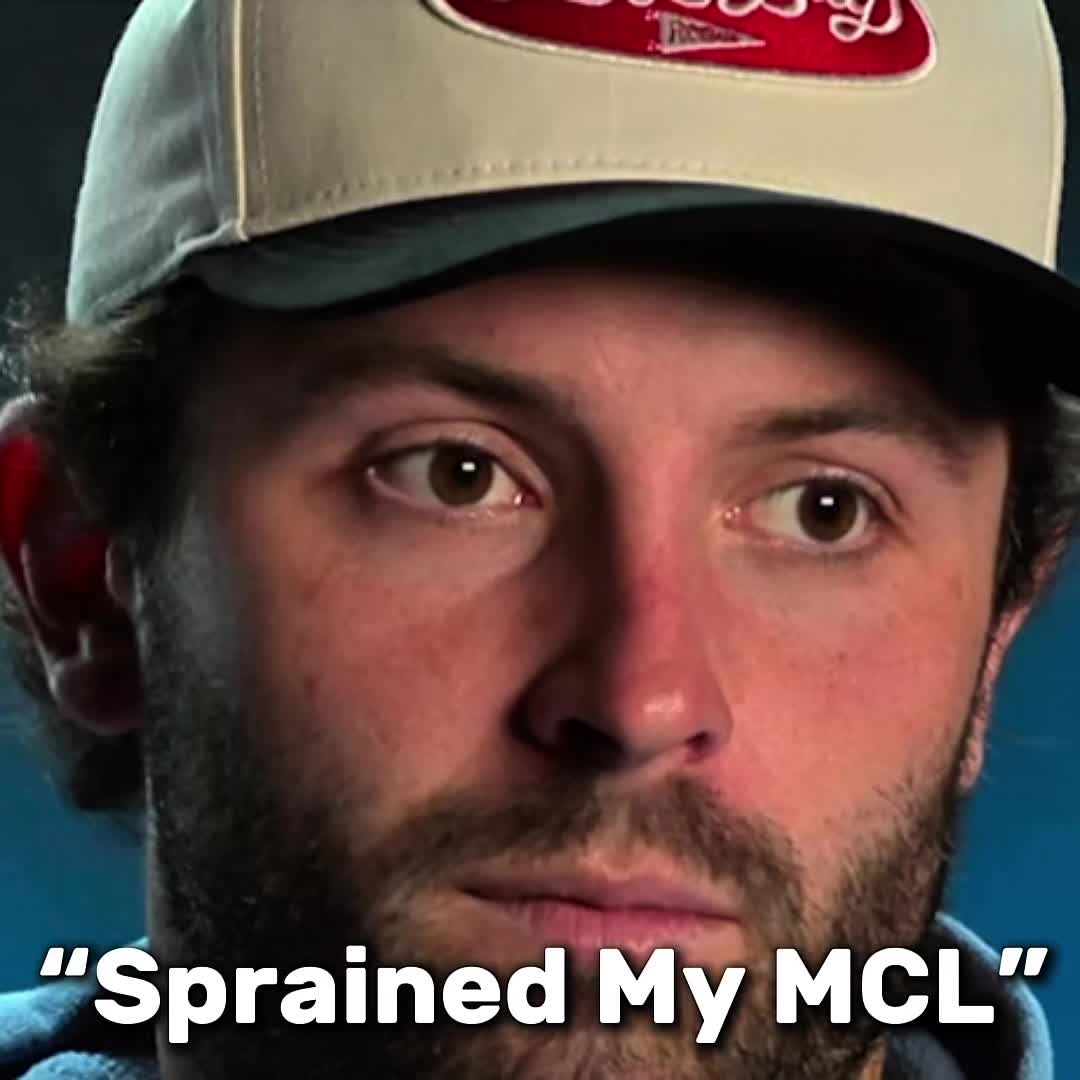 @B0
