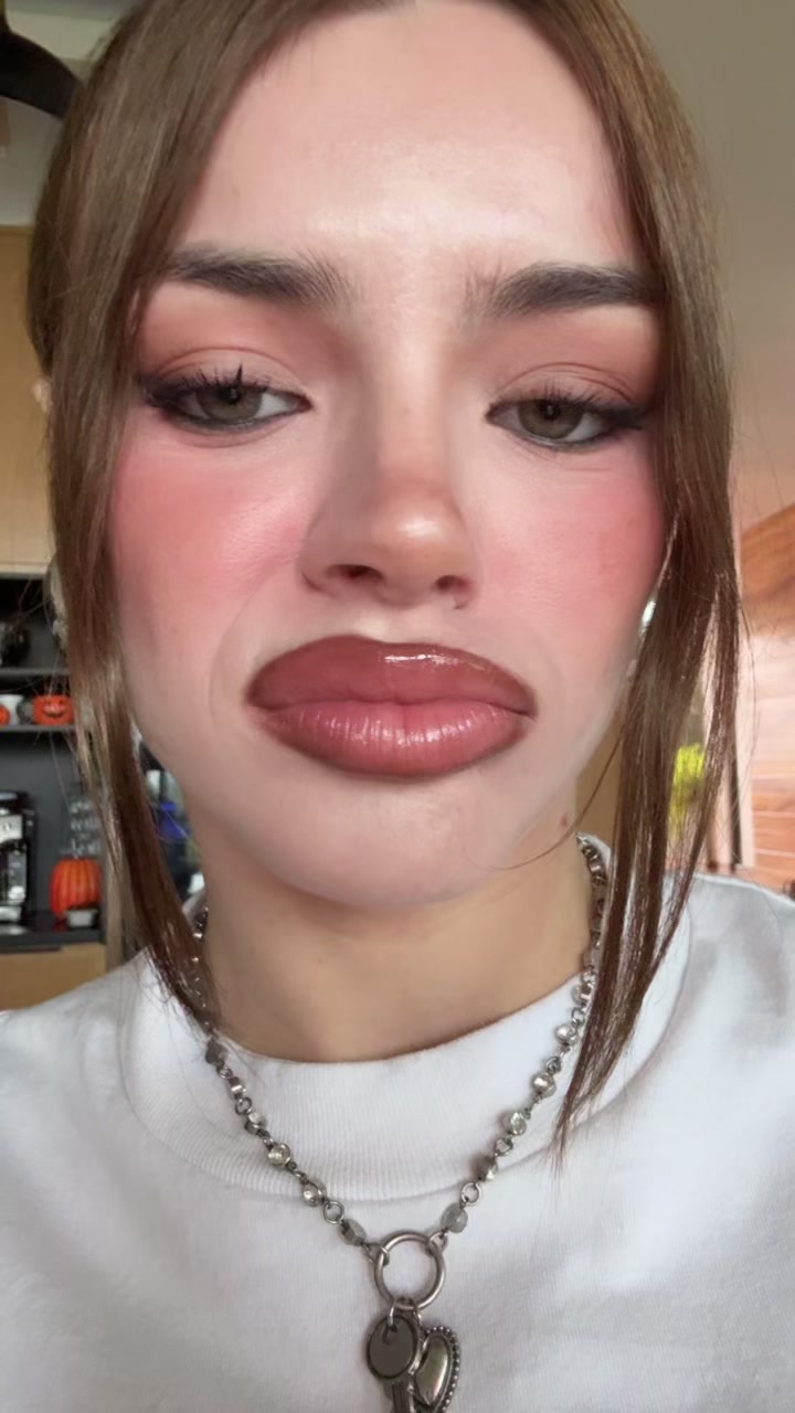 @Dani Zepoll