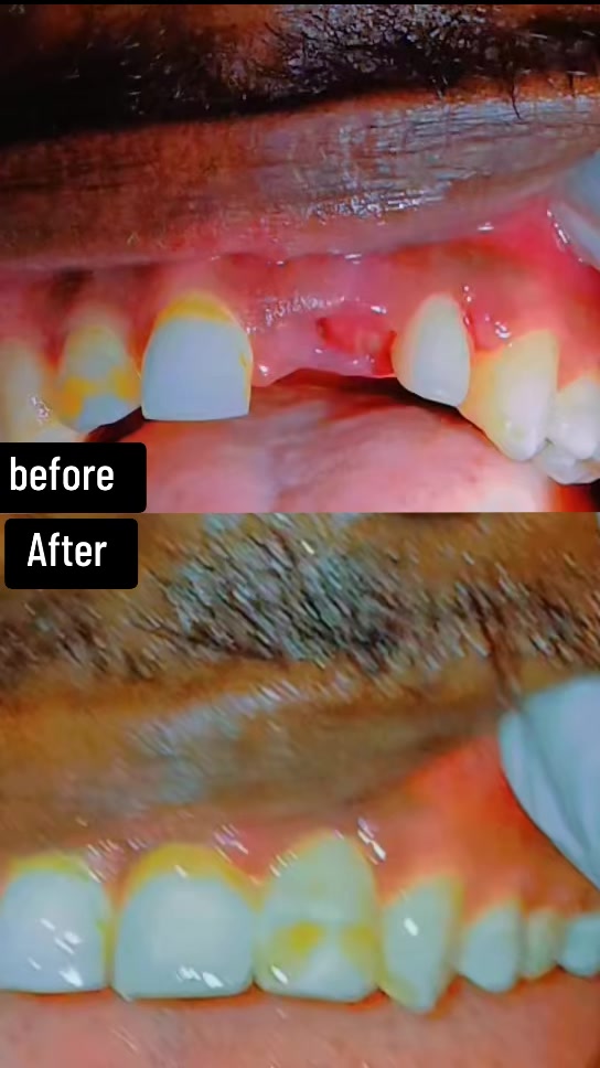 @Dr.Naasir🦷🩵🩺