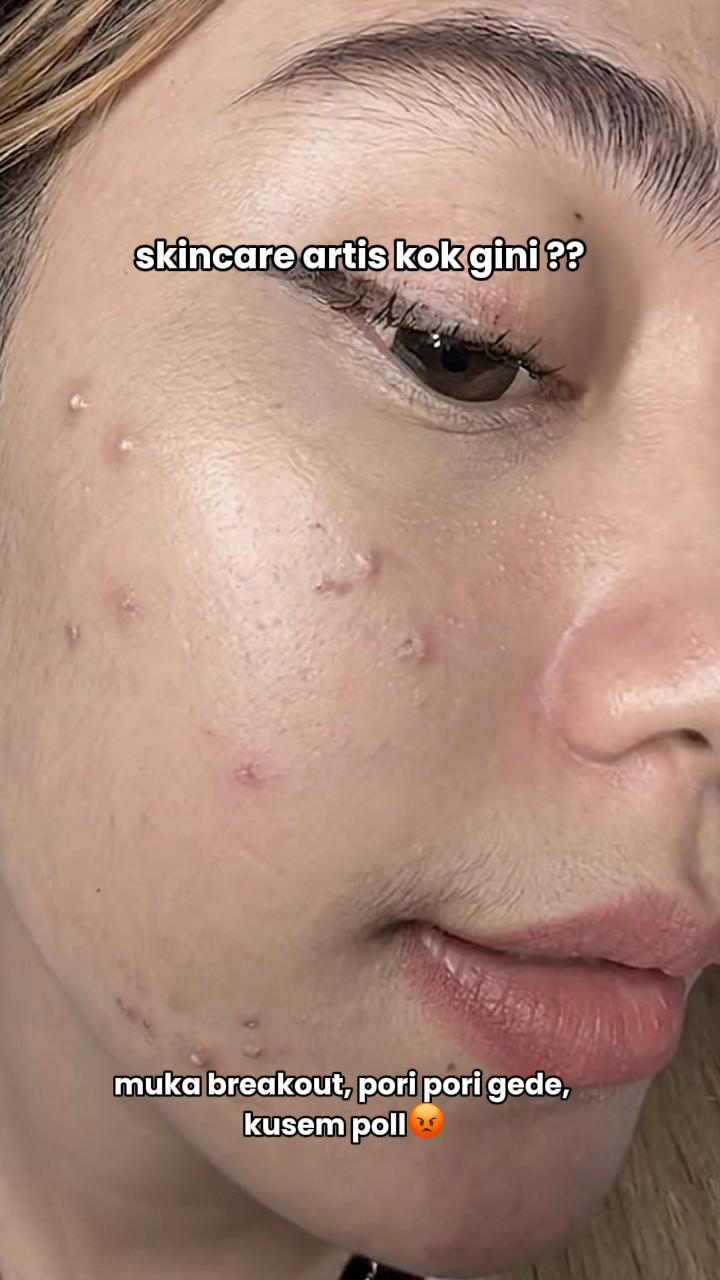 @NAMANYA EKA