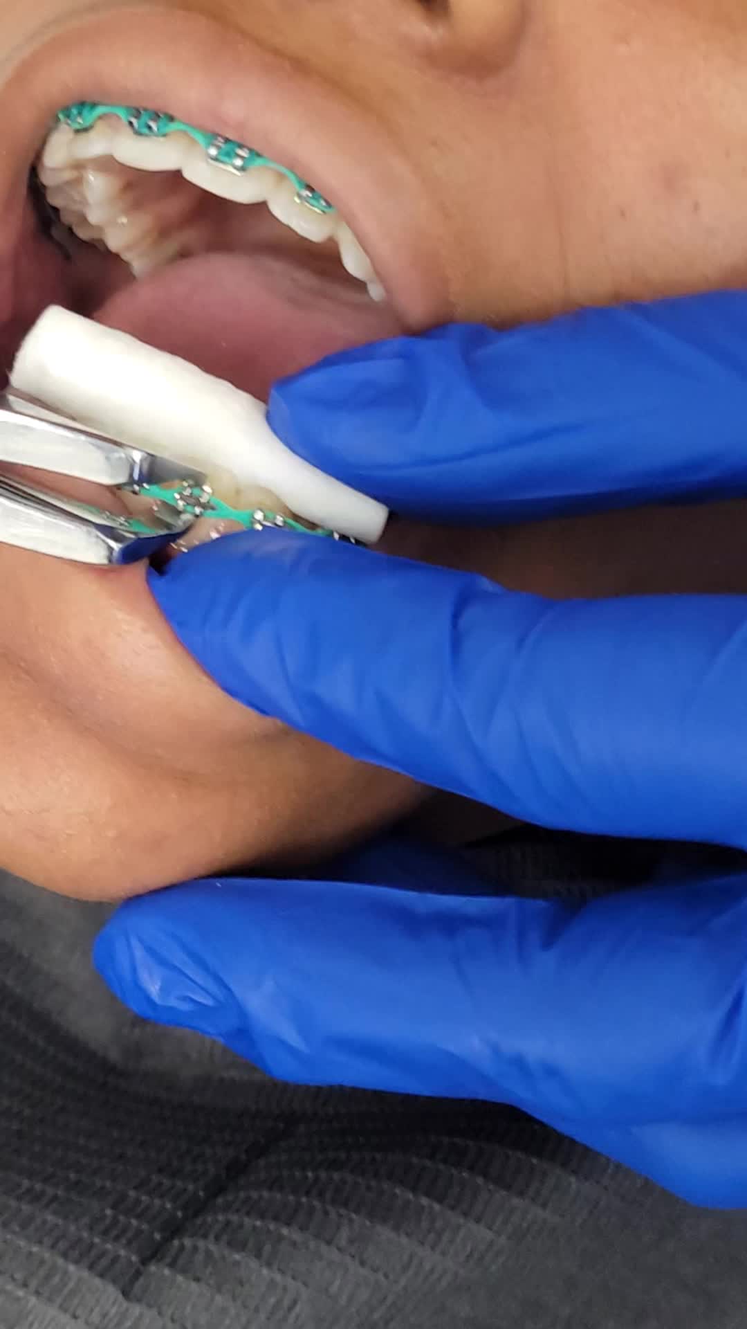 @SmileEnvyDental