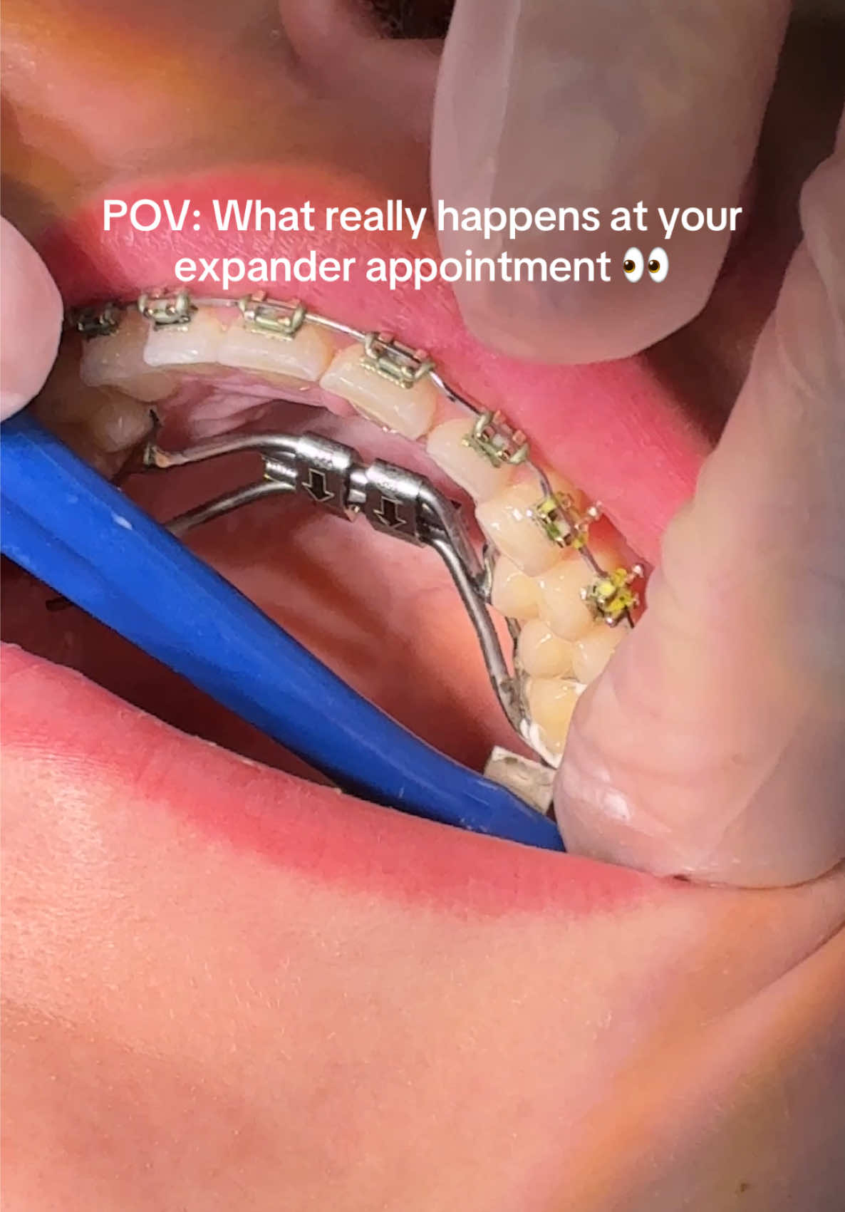 @Woodland Hills Orthodontist