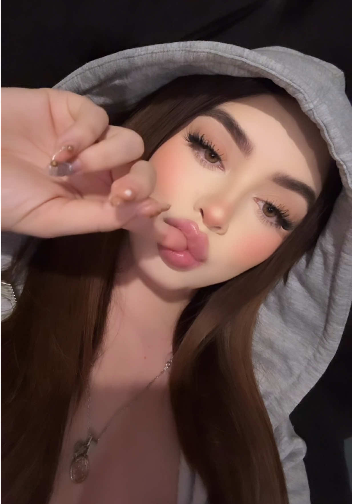 @Michell S&aacute;nchez