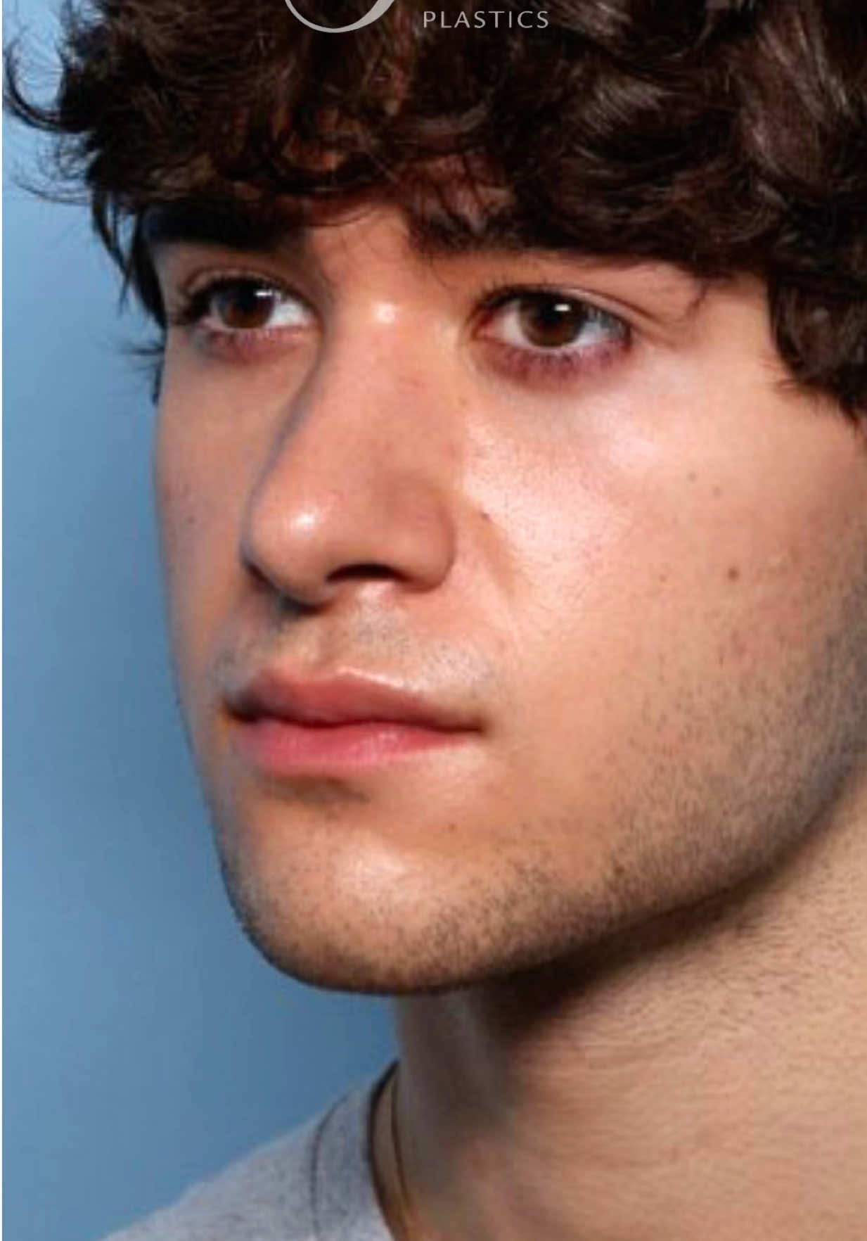 @Smith Facial Plastics