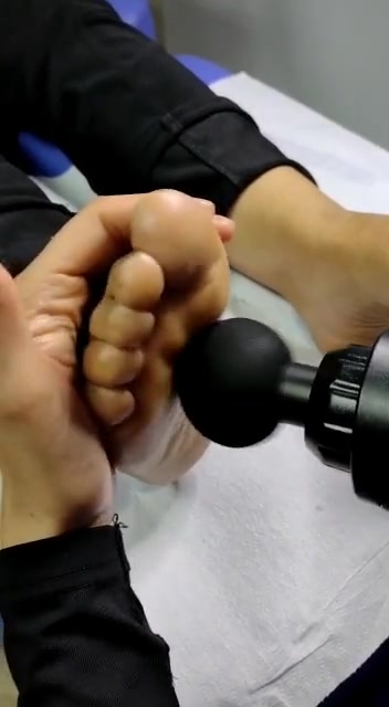 @MedicalPodoTalca importadora