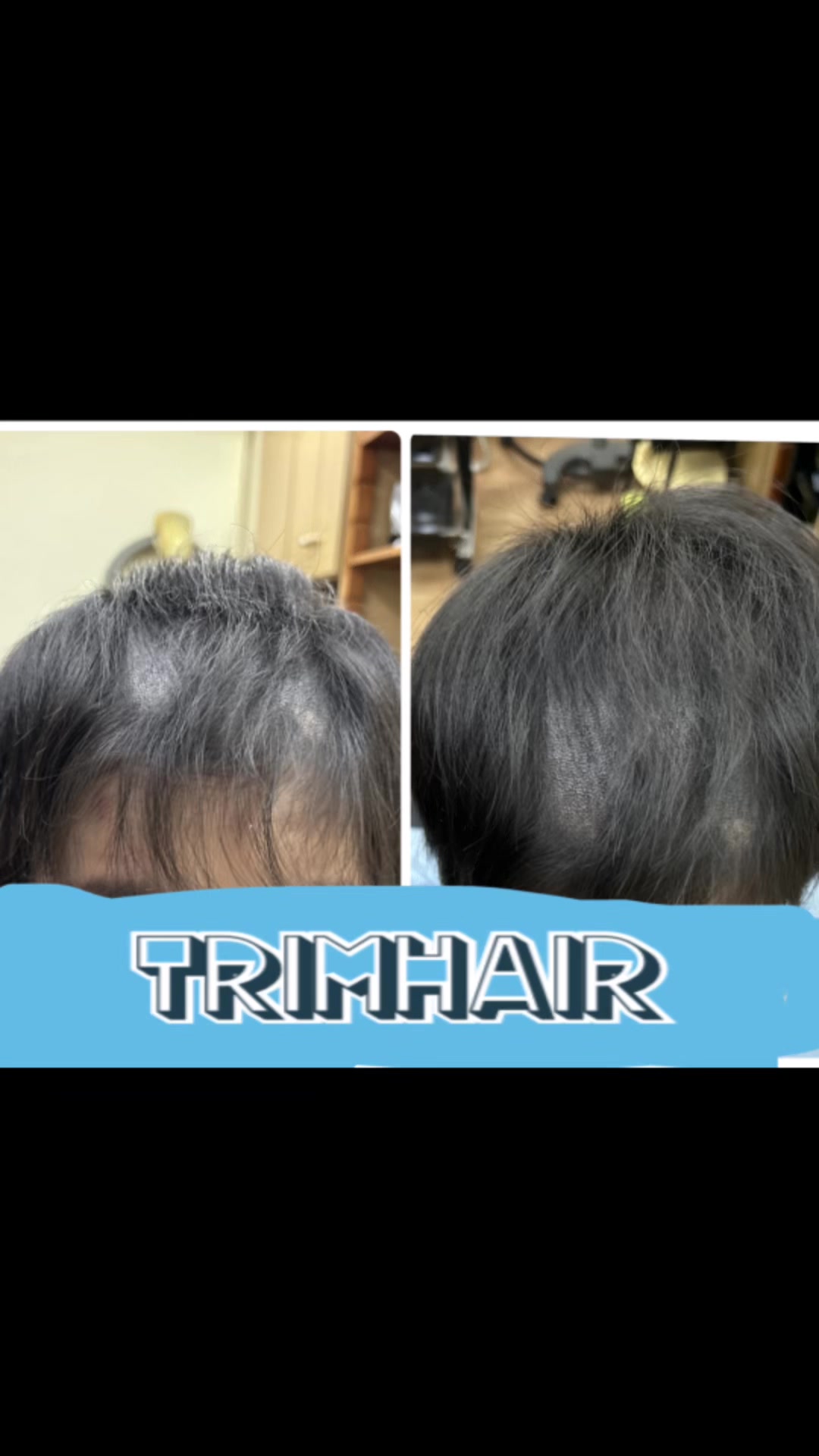 @Trim Hair