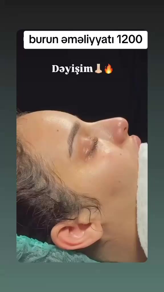 @rinoplastika_lor.dr.resad