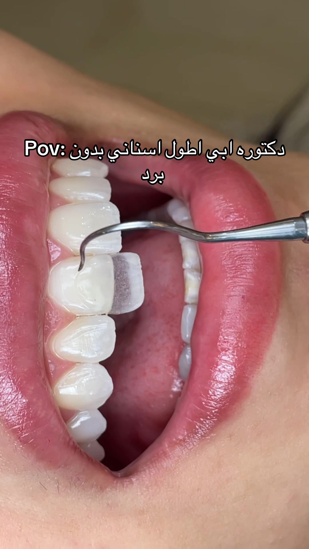 @Dr. Abrar Alhababi