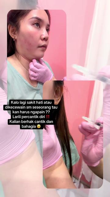 @Hainon Infus Whitening