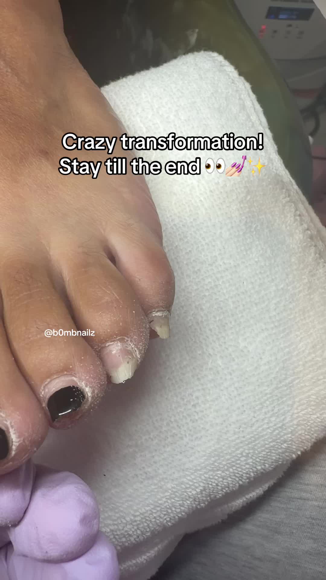 @Bombnailz