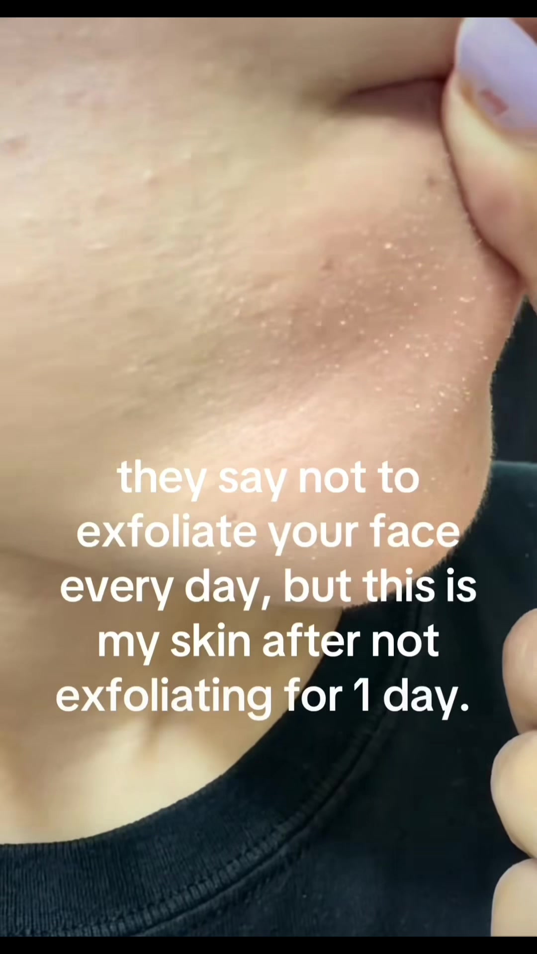 @Pure Skin OC