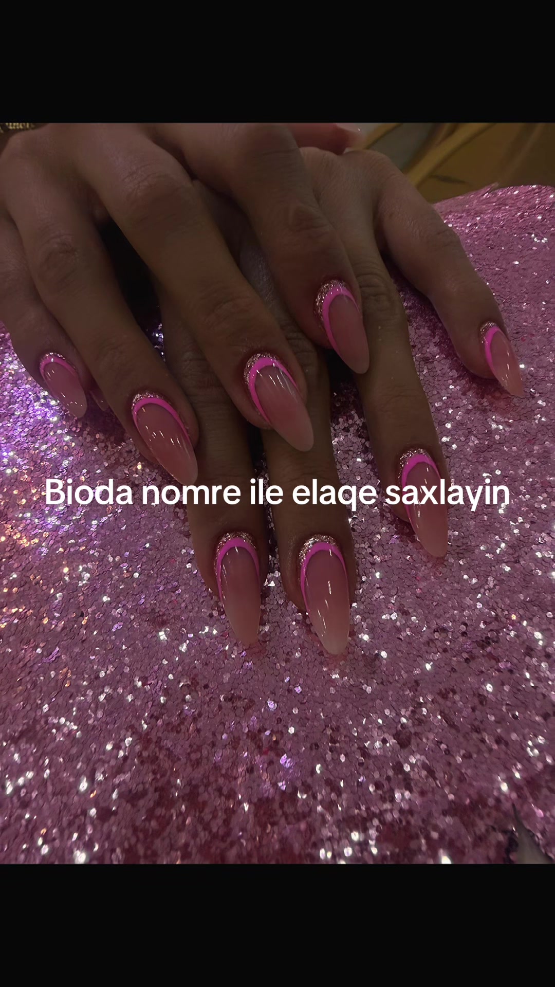 @dirnaq qaynagi naxcivan