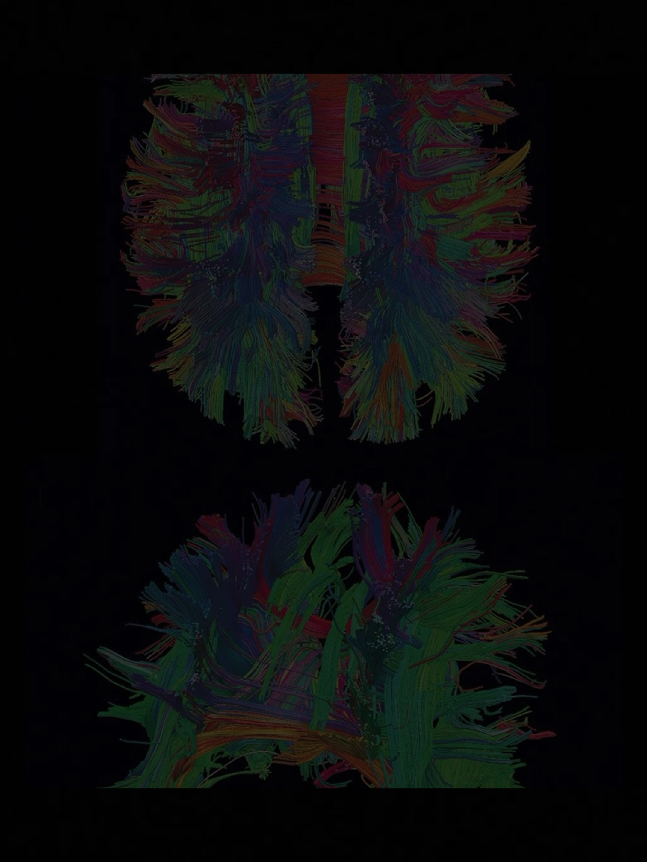@NeuroWhisper