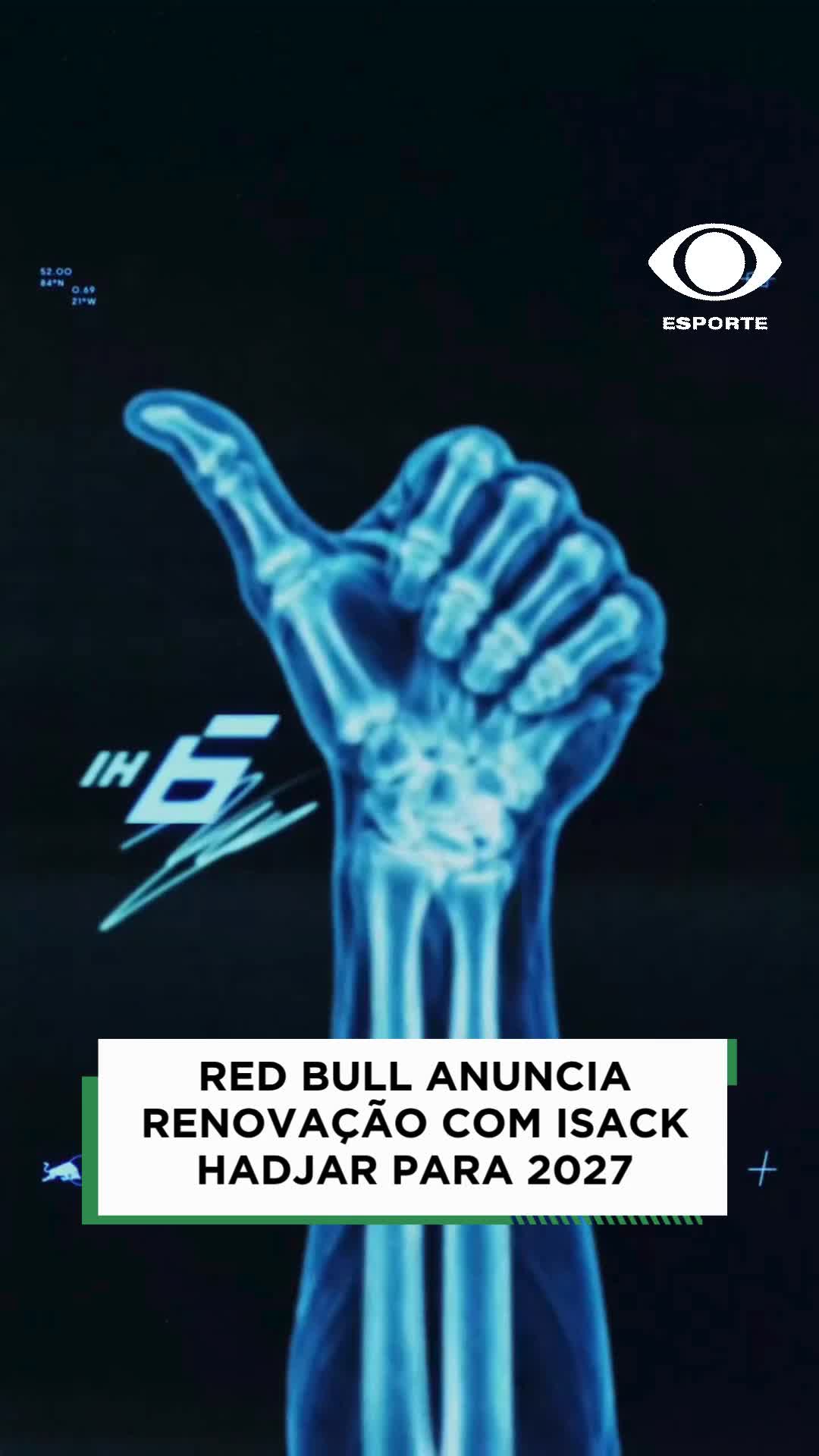@Esporte na Band