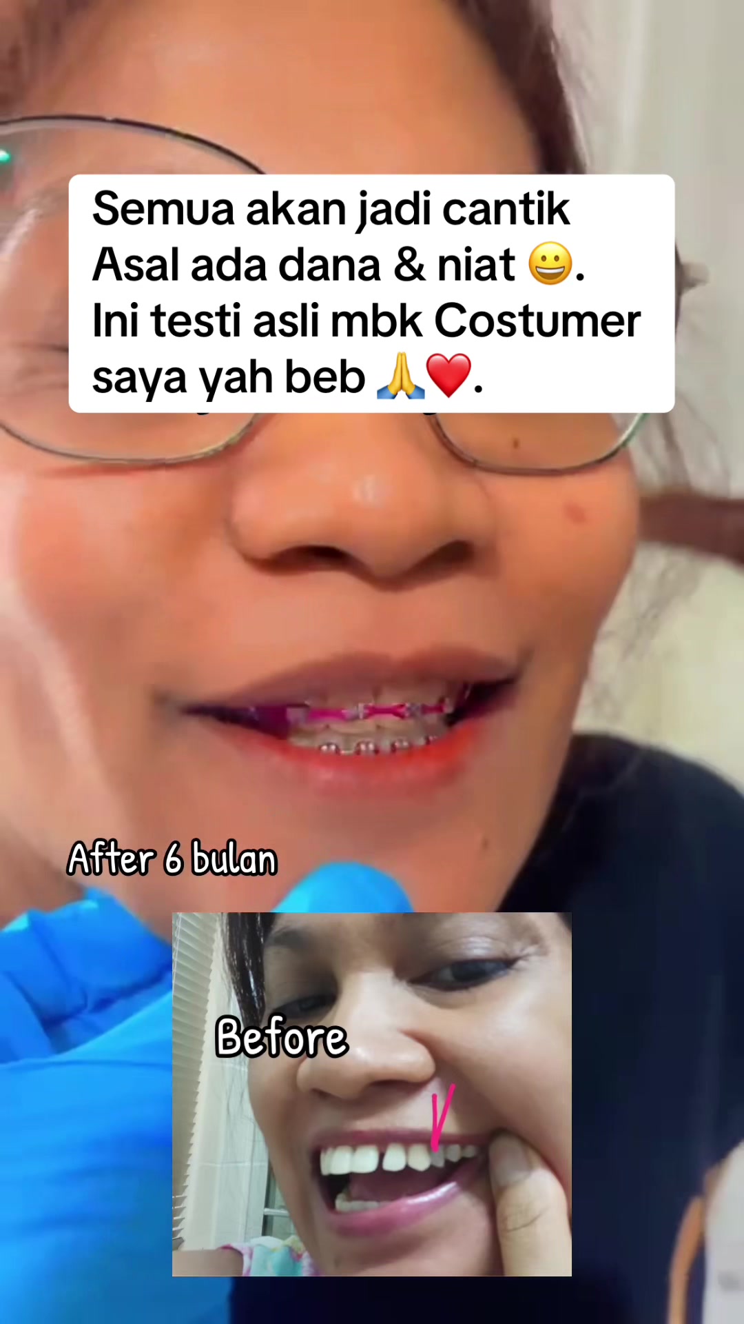 @mbak-Paijem