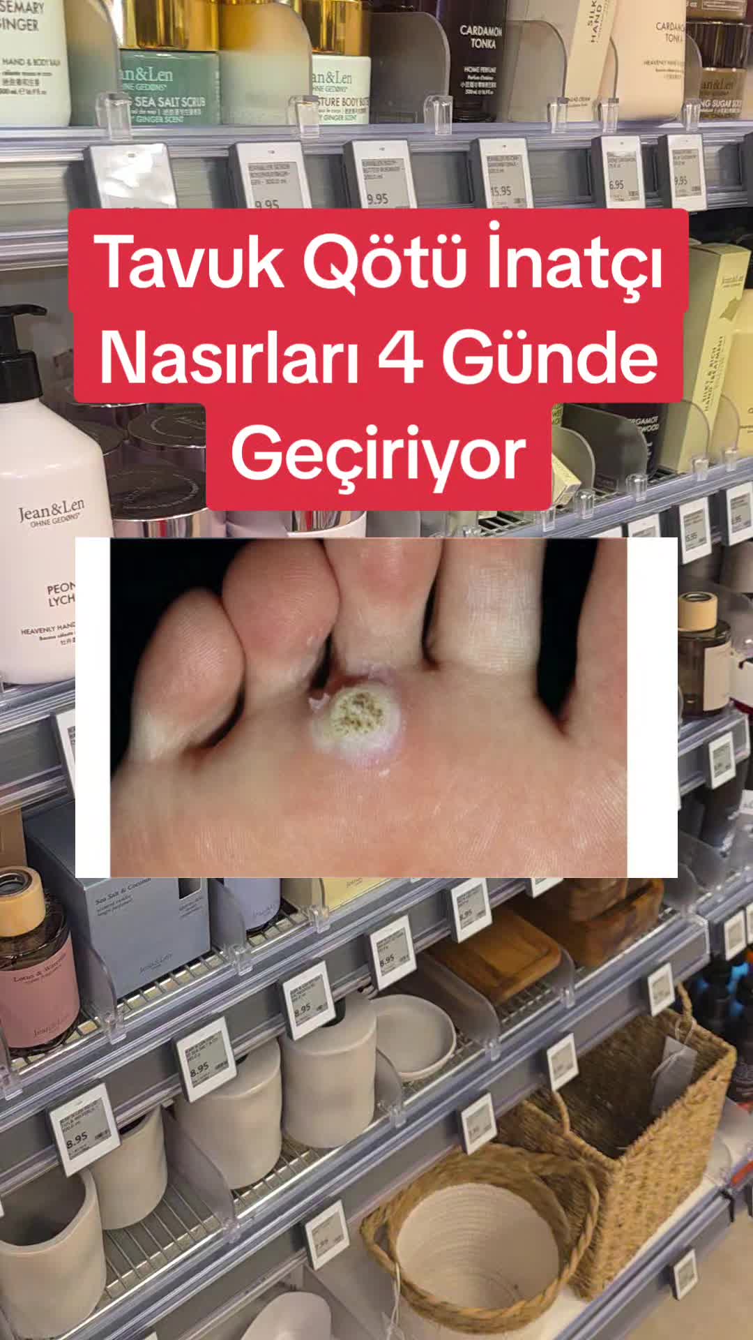@Gurbetana27