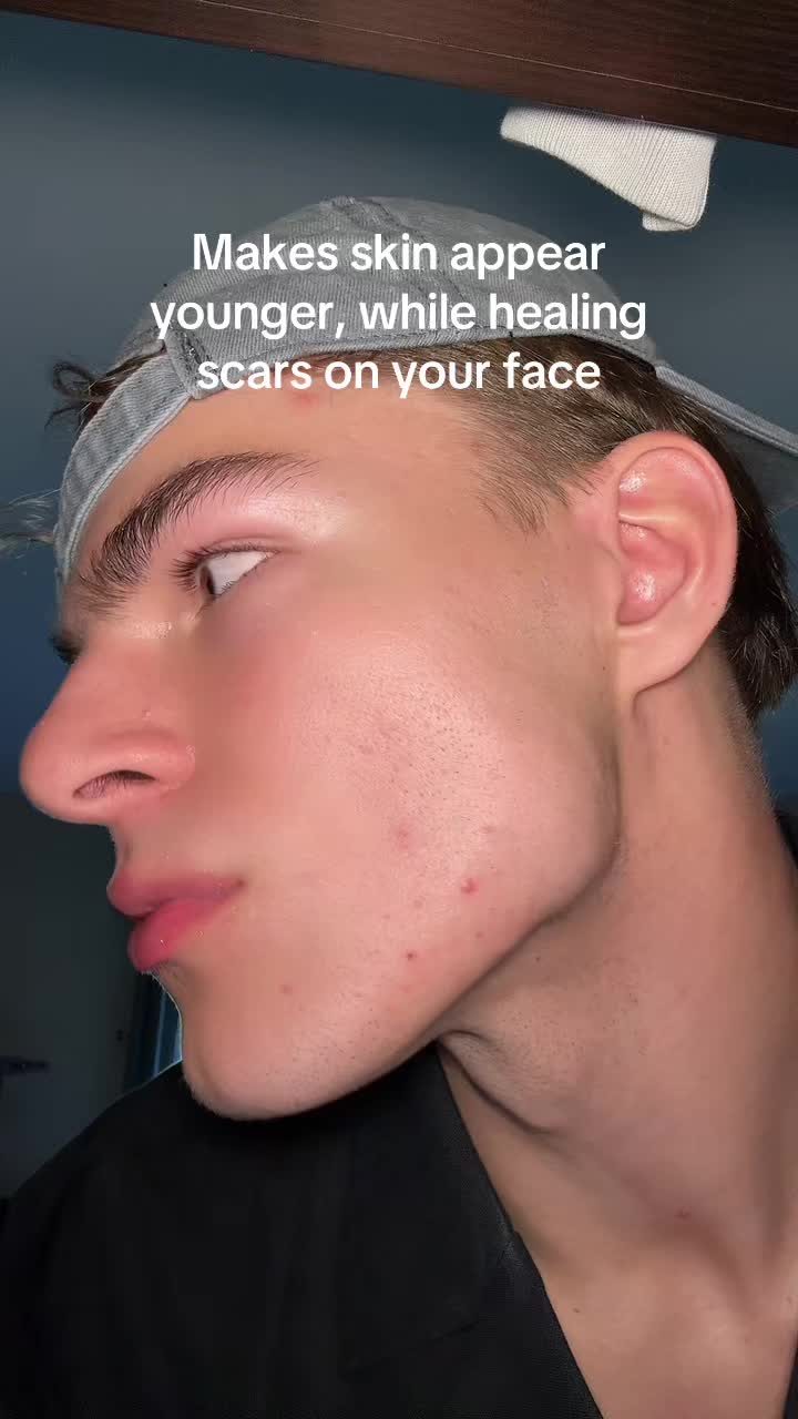 @Finn