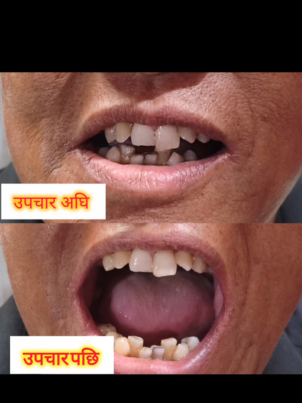 @Dr. Krishna Regmi