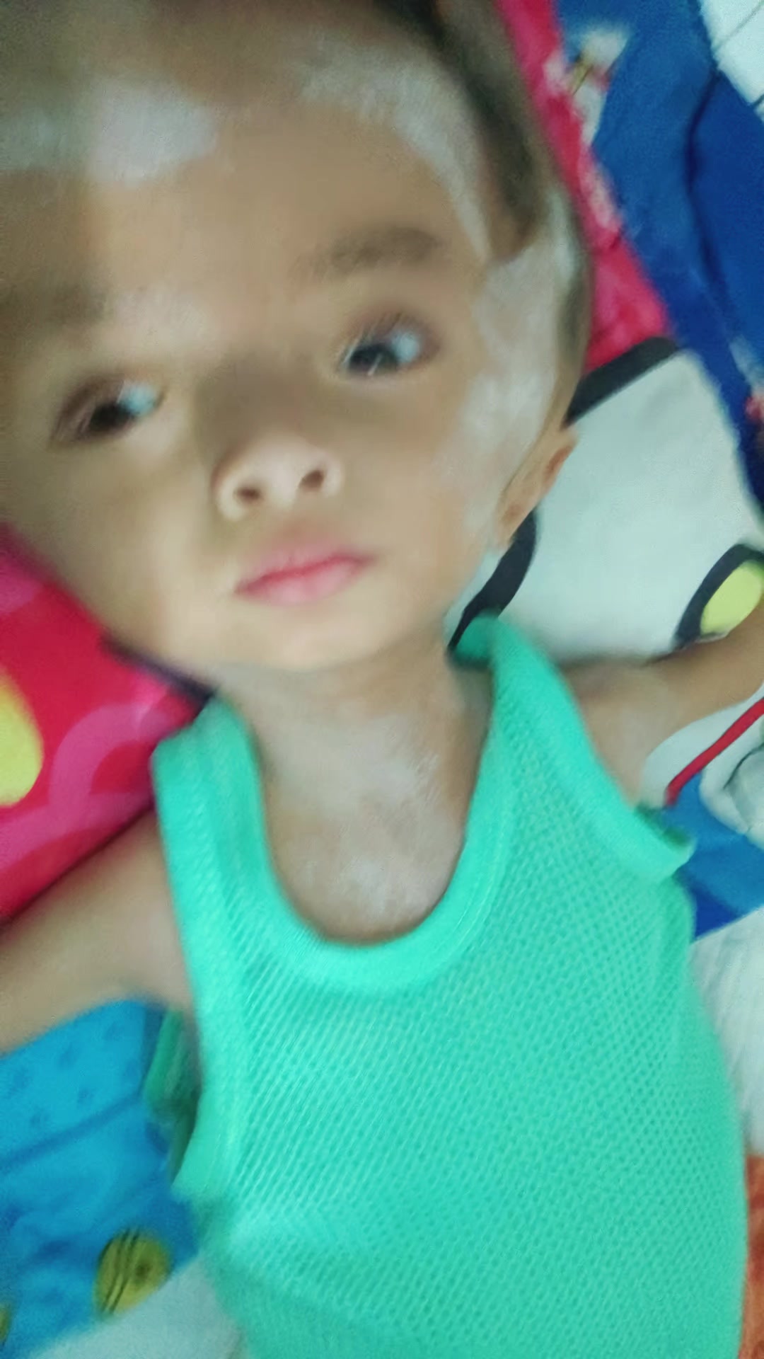 @บู้บี้เด็กหัวโตมีน้ำในโพรงสมอง