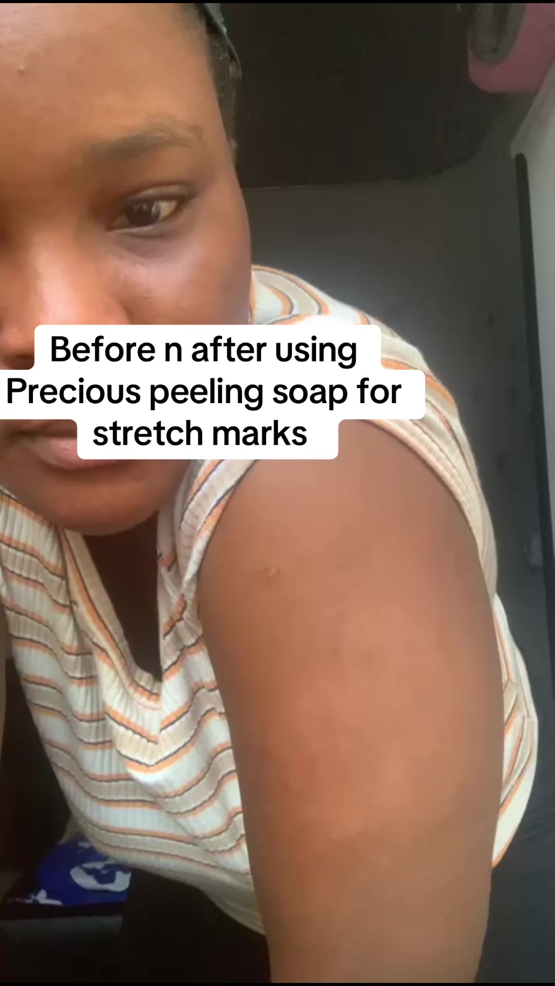 @@ Precious peeling soap