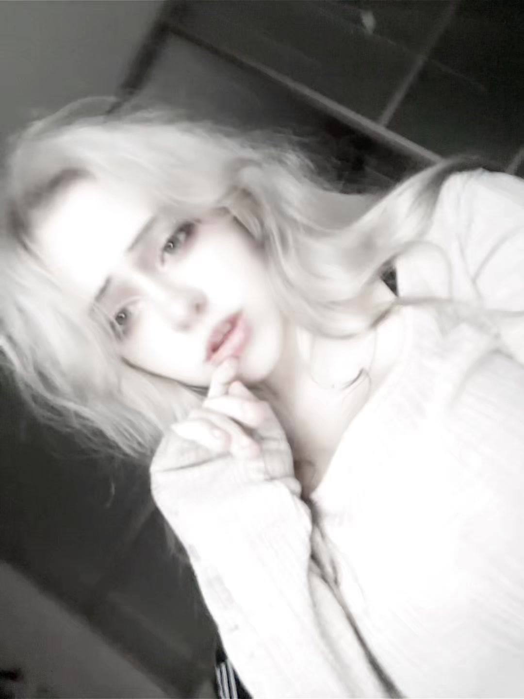 @uglyrosis