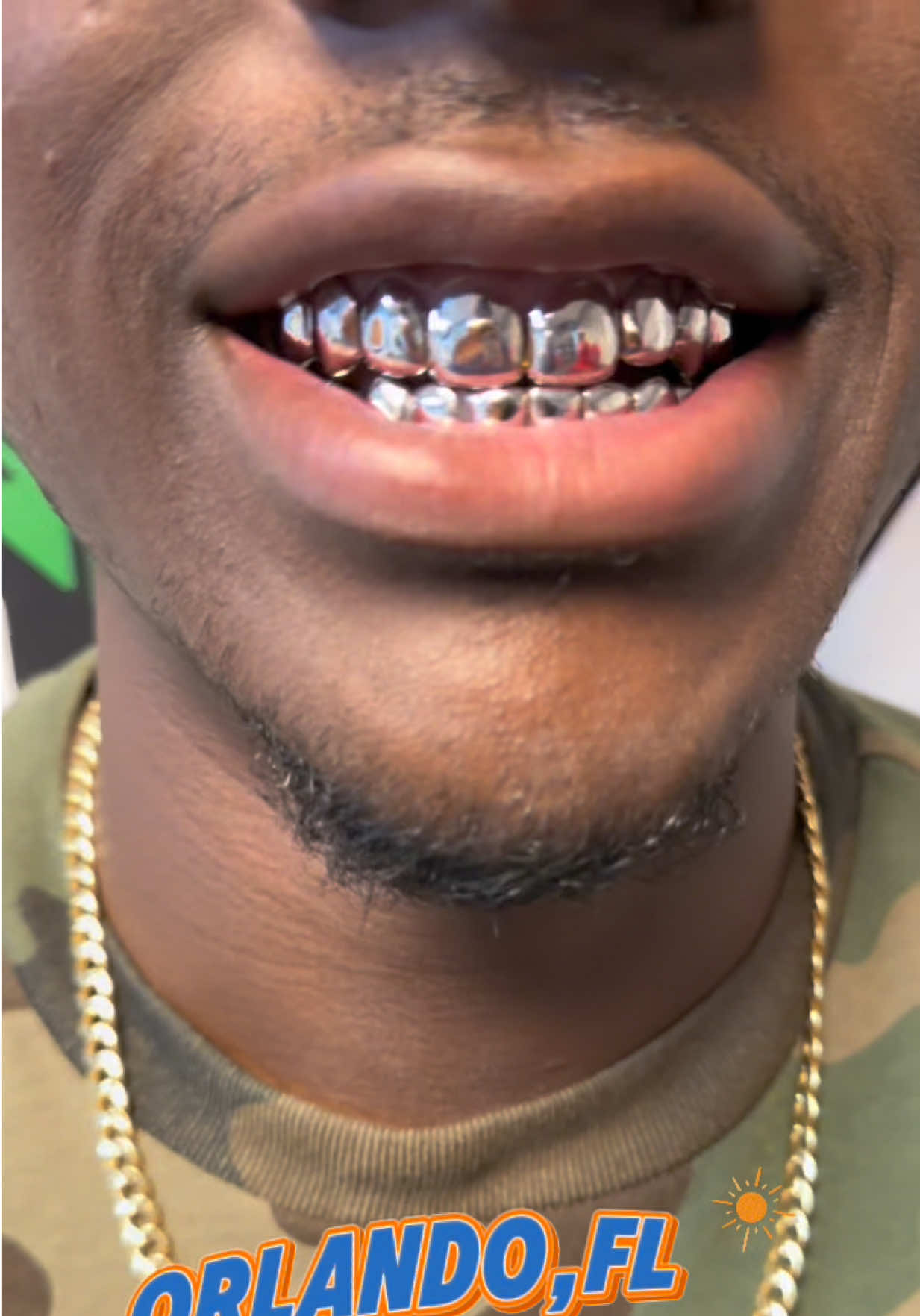 @GoldMoneyGrillz