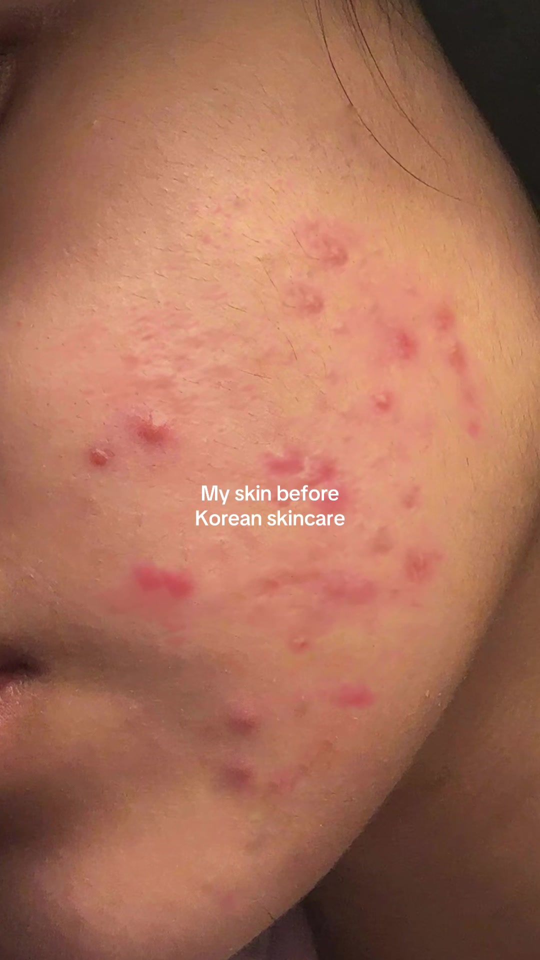 @Elinna
