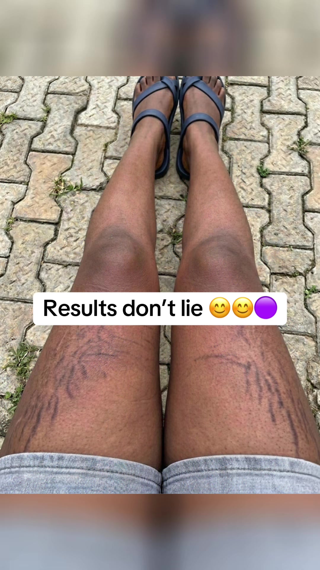 @Radiant skin
